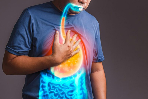 Acidity and Bloating
