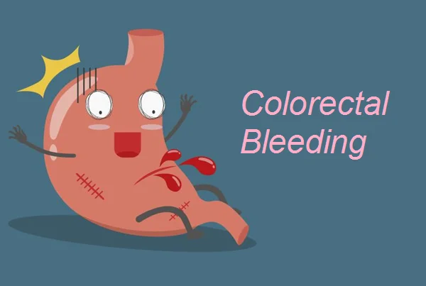 Gastrointestinal Bleeding